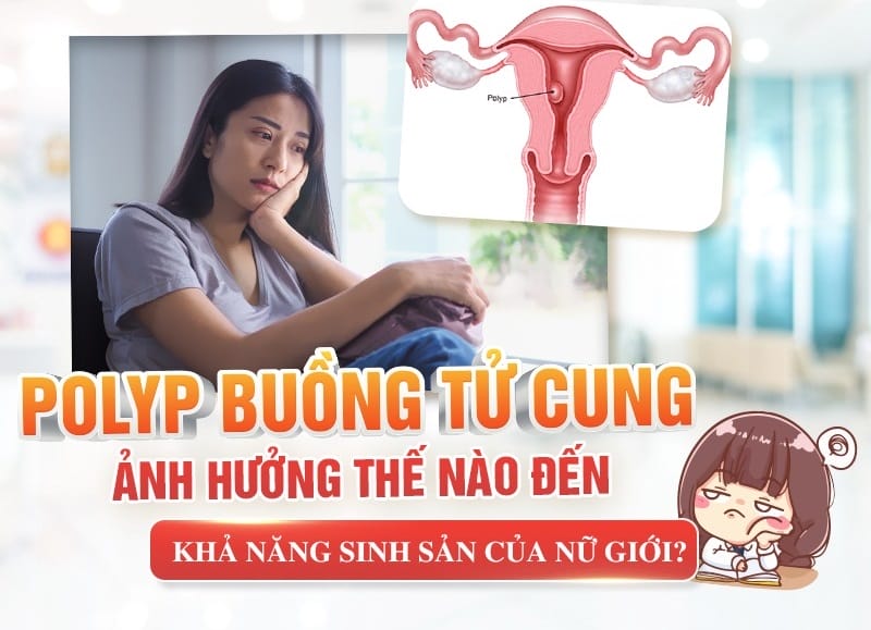 Polyp tử cung ảnh hưởng lớn khả năng sinh nở của phụ nữ