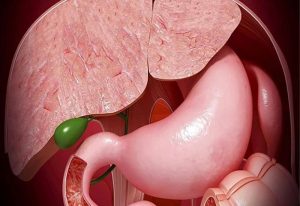 polyp túi mật có tự hết không